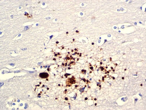 IHC of Toxoplasma gondii on an FFPE Brain Tissue